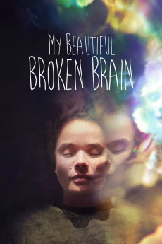 My Beautiful Broken Brain Documentary مستند