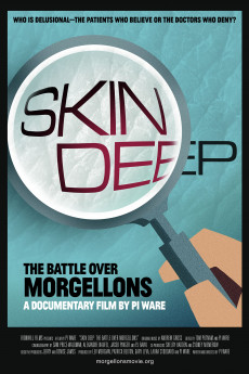 Skin Deep: The Battle Over Morgellons Documentary مستند